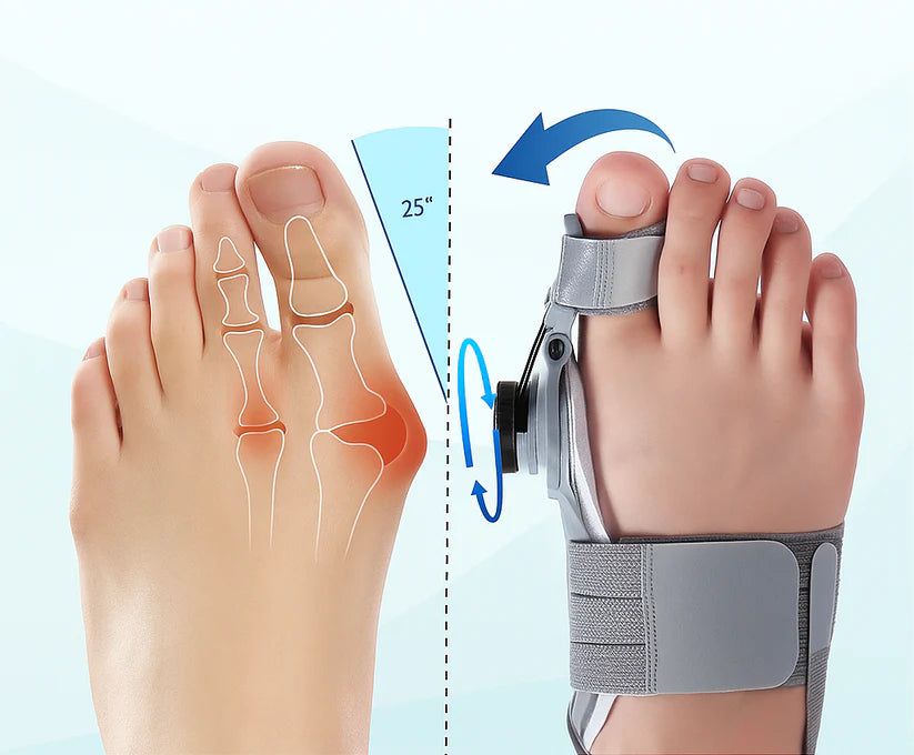 StepBalance™ — Corrector de Juanetes Comfort Plus para Alineación Natural del Pie