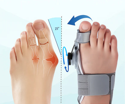 StepBalance™ — Corrector de Juanetes Comfort Plus para Alineación Natural del Pie