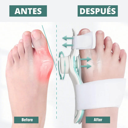 StepBalance™ — Corrector de Juanetes Comfort Plus para Alineación Natural del Pie