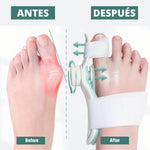 StepBalance™ — Corrector de Juanetes Comfort Plus para Alineación Natural del Pie