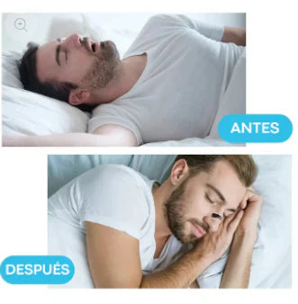 AirZen™ Kit 4 dilatadores nasales + 30 parches magnéticos