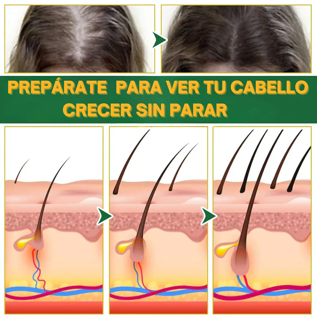Ouhoe - Tu elixir mágico para el crecimiento del cabello⭐⭐⭐⭐⭐